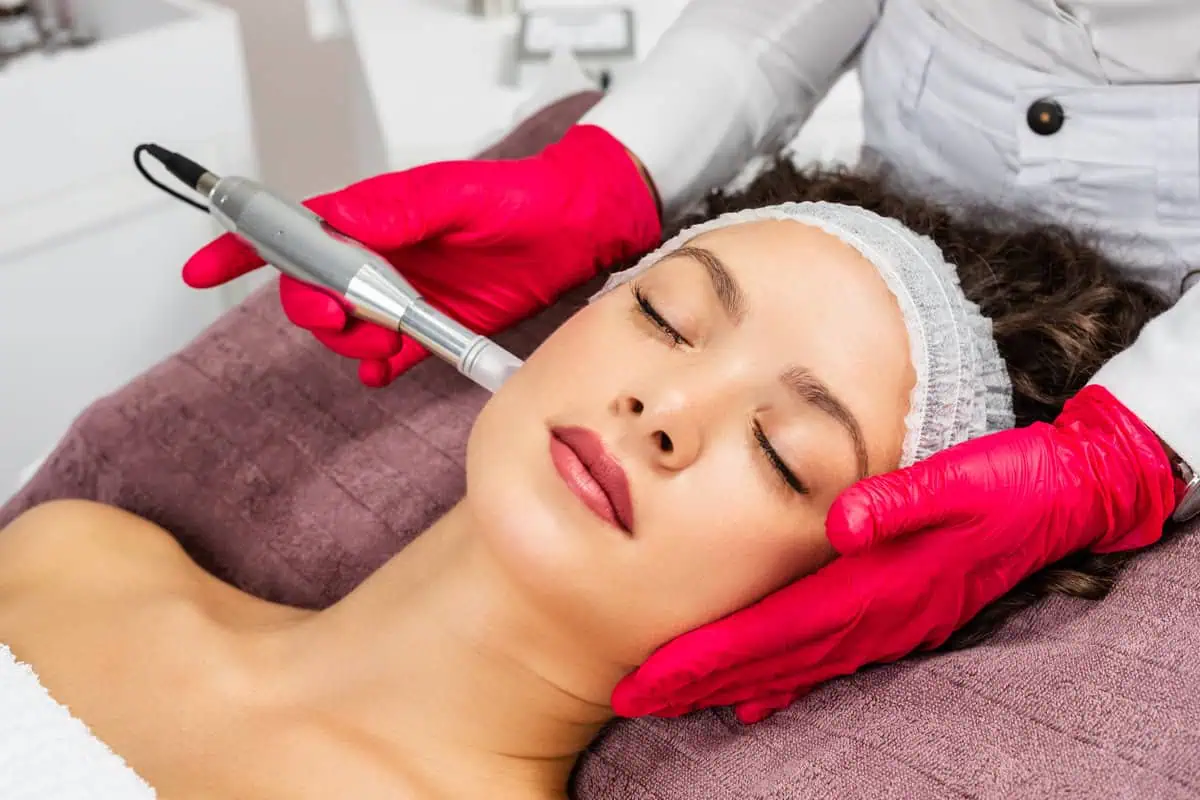 RF Microneedling by DMC Aesthetics in Tuscon, AZ