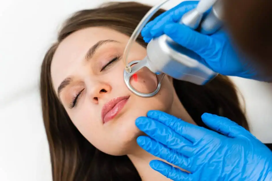 Laser Treatments by DMC Aesthetics in Tucson, AZ